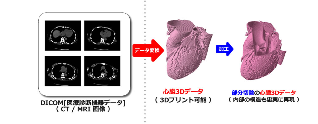 3D 画像データ変換